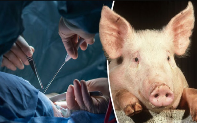 Появятся ли на свет свиньи с человеческими органами? 